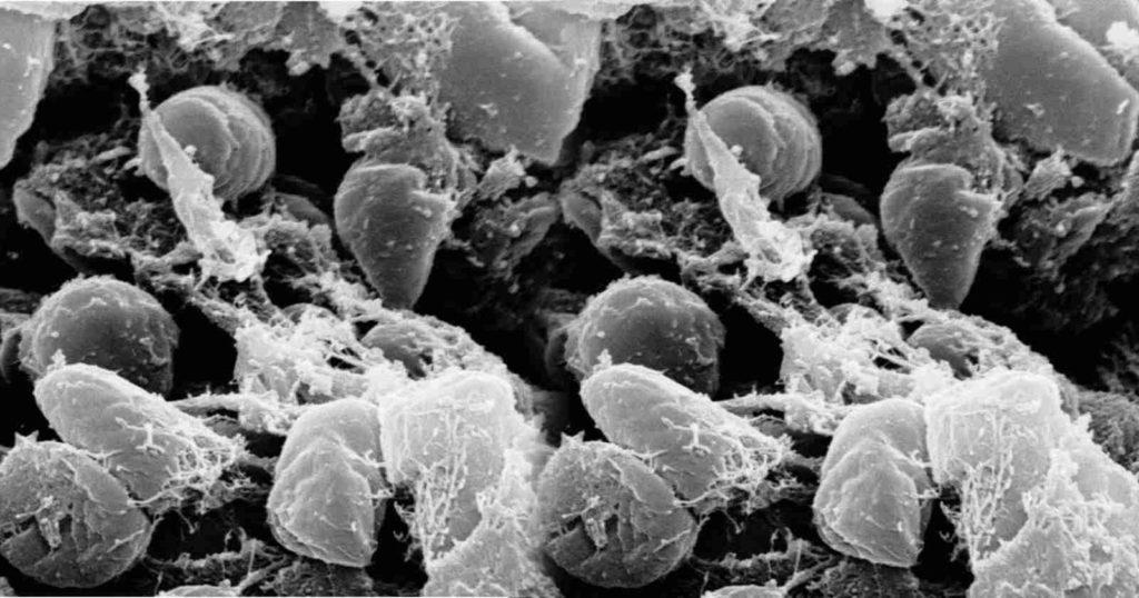 Plague in China: চিনের এই প্লেগ কতটা ভয়ংকর হয়ে উঠতে পারে?